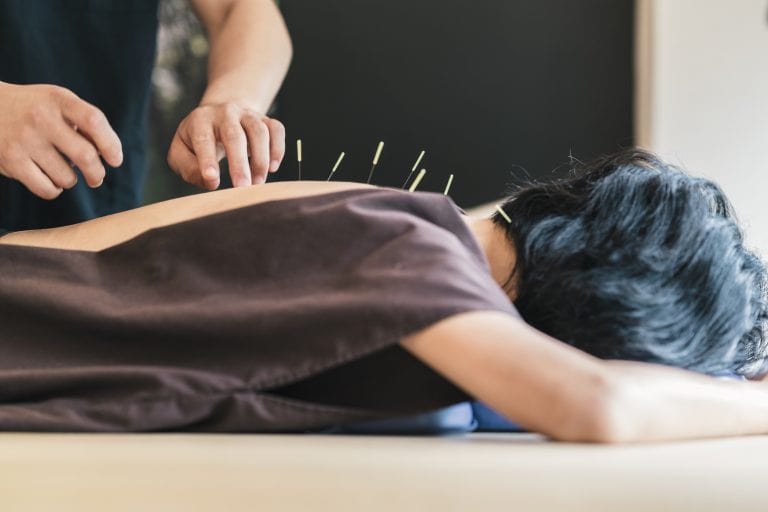 Physio et acupuncture